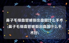 鼻子毛细血管破裂出血做什么手术(鼻子毛细血管破裂出血做什么手术好)