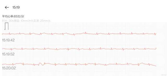 把你的心交给它吧！OPPO Watch 2 ECG版上手体验