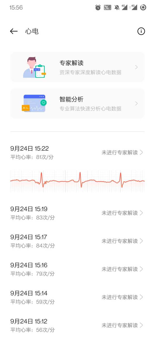 把你的心交给它吧！OPPO Watch 2 ECG版上手体验