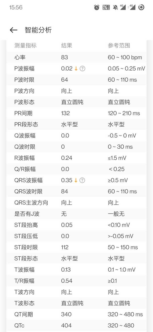 把你的心交给它吧！OPPO Watch 2 ECG版上手体验