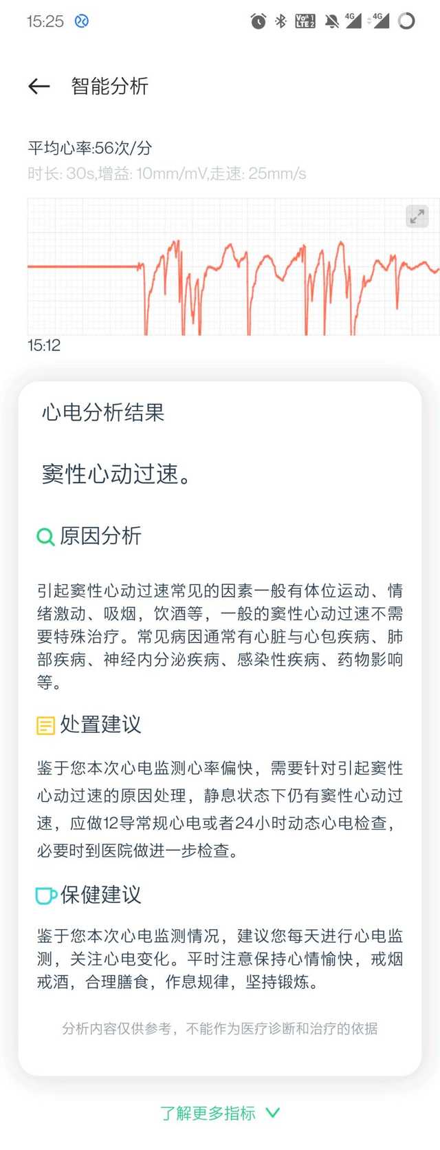 把你的心交给它吧！OPPO Watch 2 ECG版上手体验