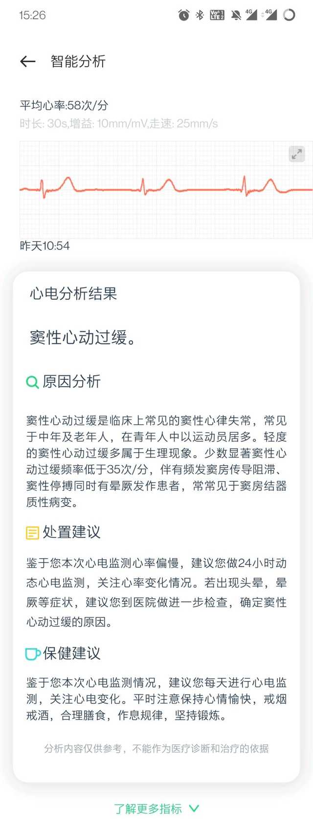 把你的心交给它吧！OPPO Watch 2 ECG版上手体验